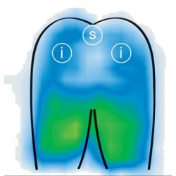 Viscoflex Plus Cushion - High-Density Viscoelastic Foam Cushion for Optimal Pressure Relief. - CareSupplies.com Medical Equipmen